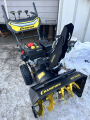 Снегоотбрасыватель Champion ST763E